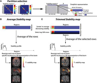 Detection of abnormal resting-state networks in individual patients suffering from focal epilepsy: an initial step toward individual connectivity assessment